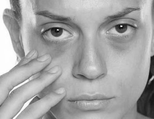 Τα απολεπιστικά προϊόντα ερεθίζουν το ευαίσθητο δέρμα